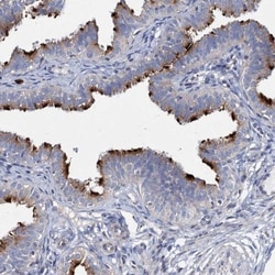CBCP6 Antibody, Novus Biologicals 25 &mu;L; Unlabeled:Antibodies, Polyclonal